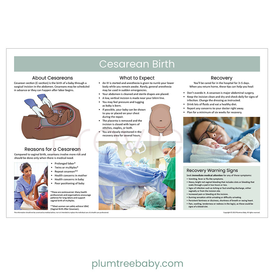 Cesarean Birth Poster-Poster-Plumtree Baby