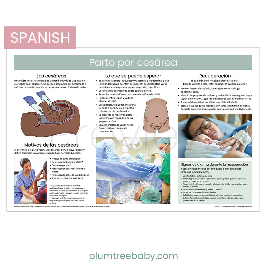 Cesarean Birth Poster-Poster-Plumtree Baby