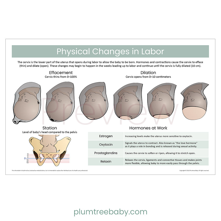 Physical Changes in Labor Poster-Poster-Plumtree Baby